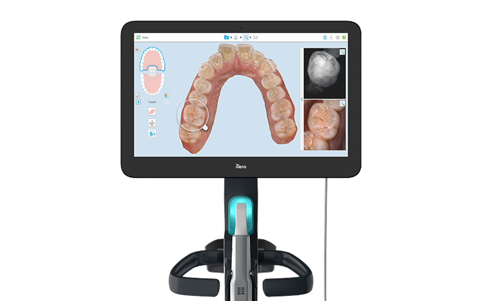 口腔内スキャナー（iTero）