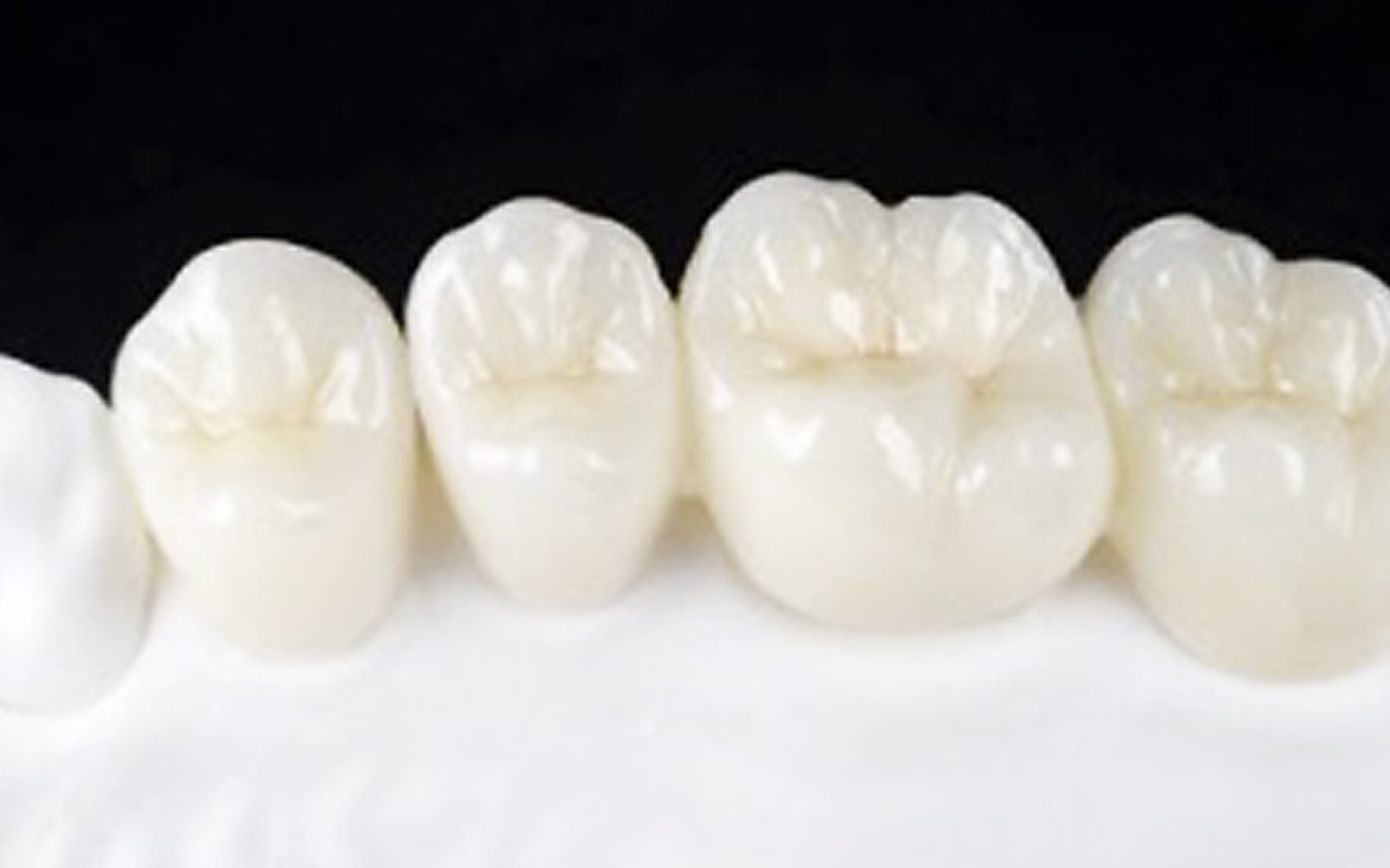 ジルコニアステインクラウン