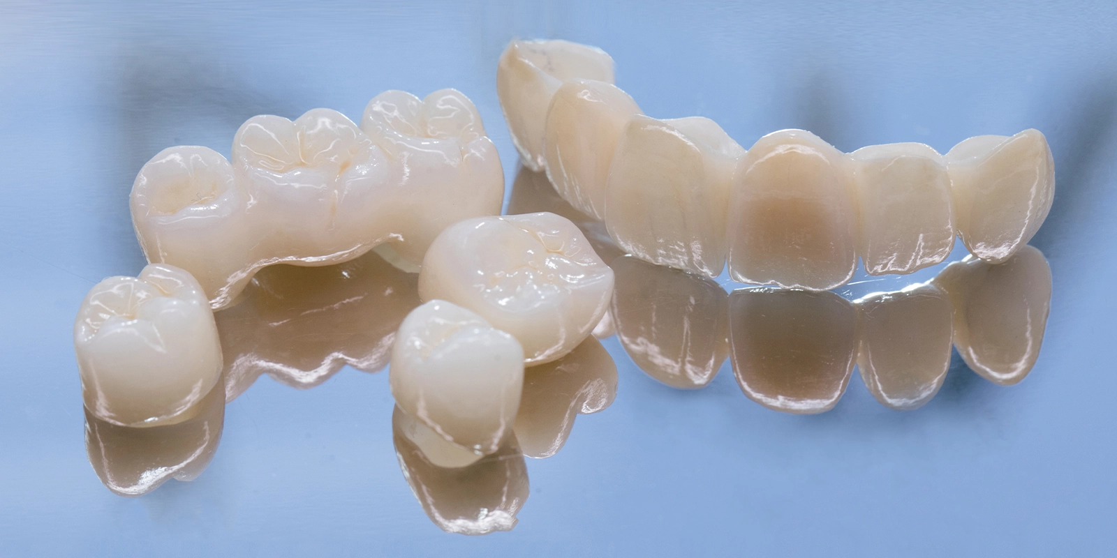 銀歯に使われる金属の問題点と、セラミックが選ばれる理由