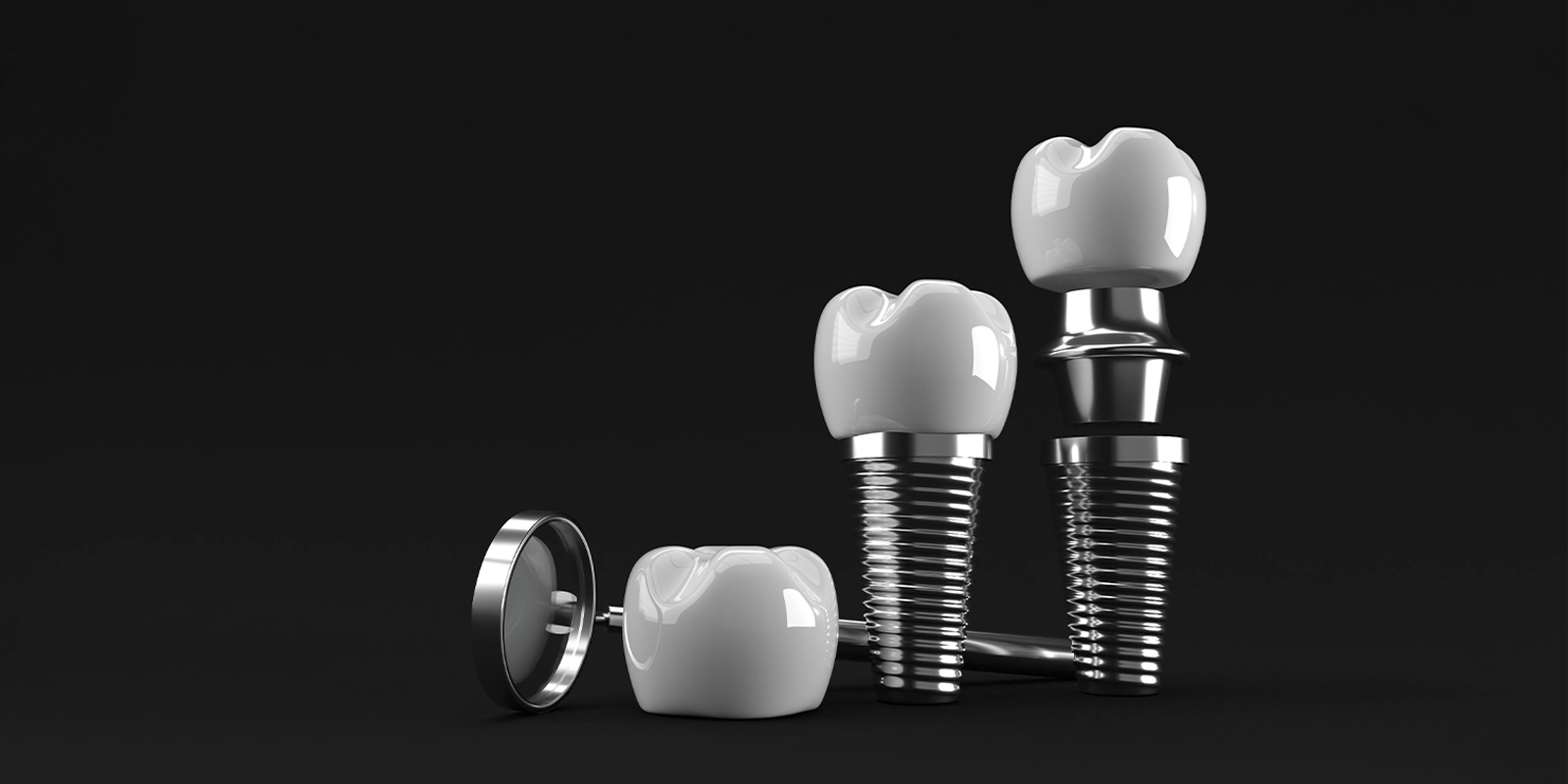 インプラントの構造と、天然歯に近い機能を取り戻せる理由