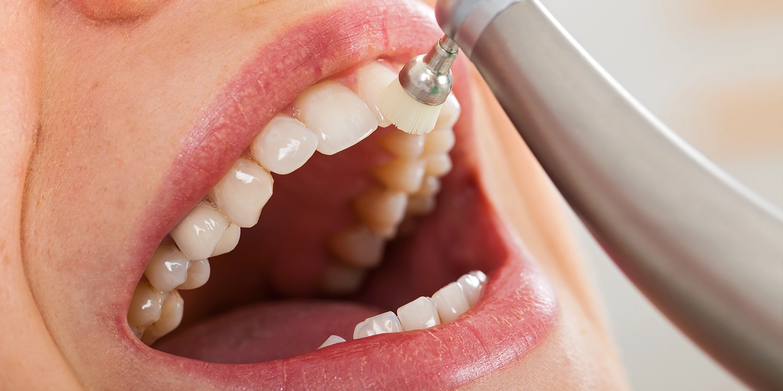 安定確認と定期メインテナンスへの移行