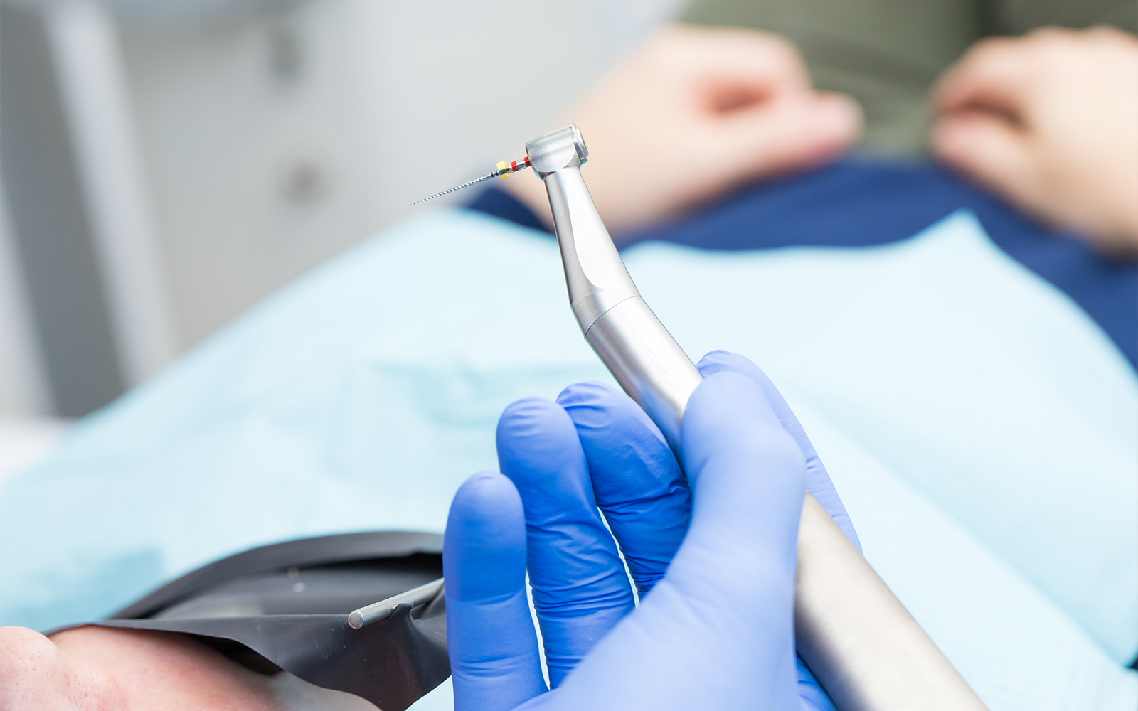 中〜重度の虫歯・根管治療が必要な場合