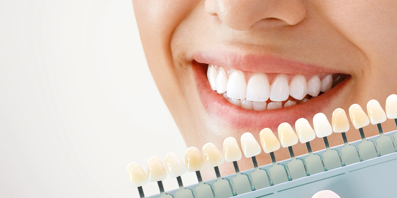 歯が変色する仕組みと、ホワイトニングで白くなる理由