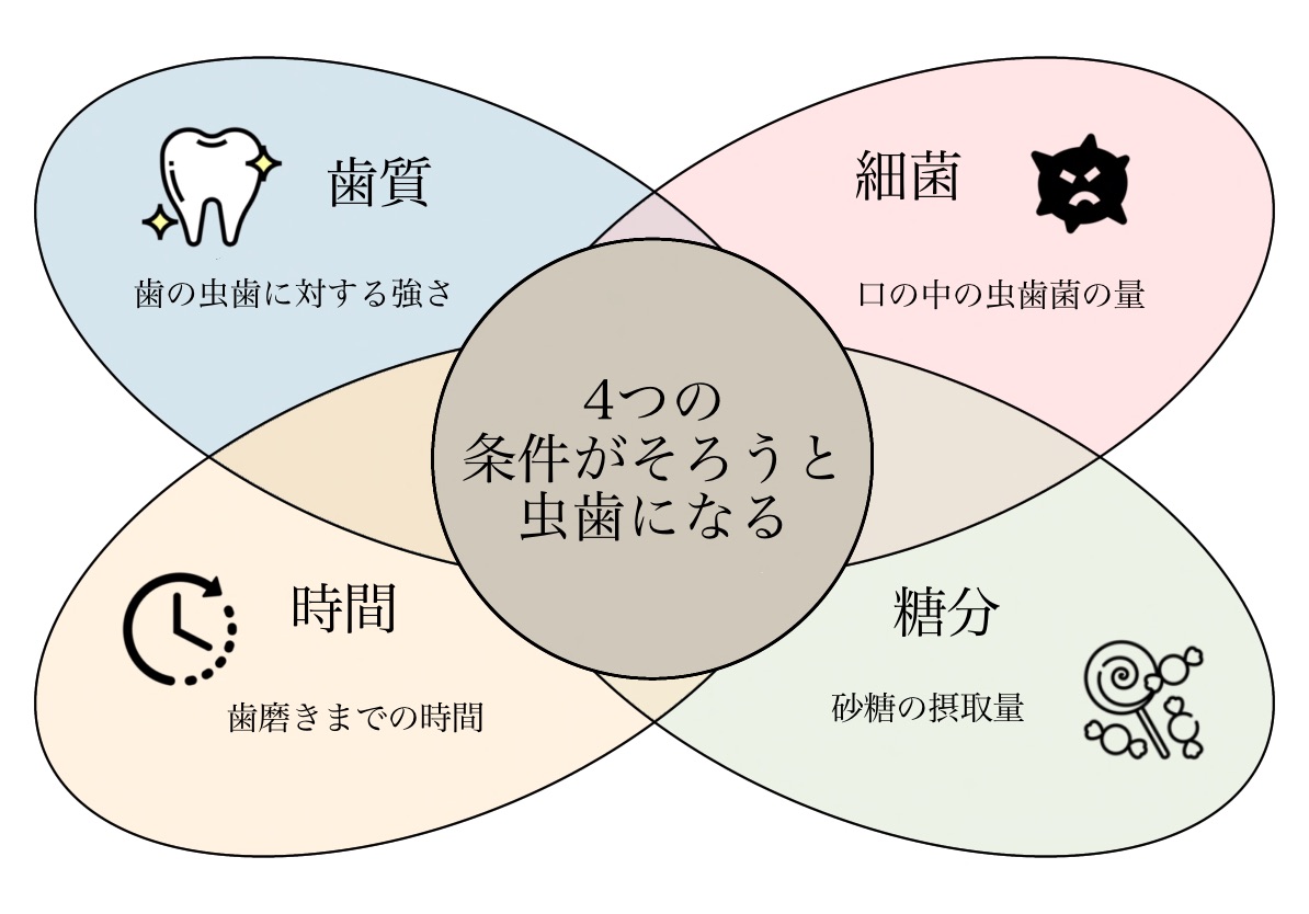 虫歯になる条件